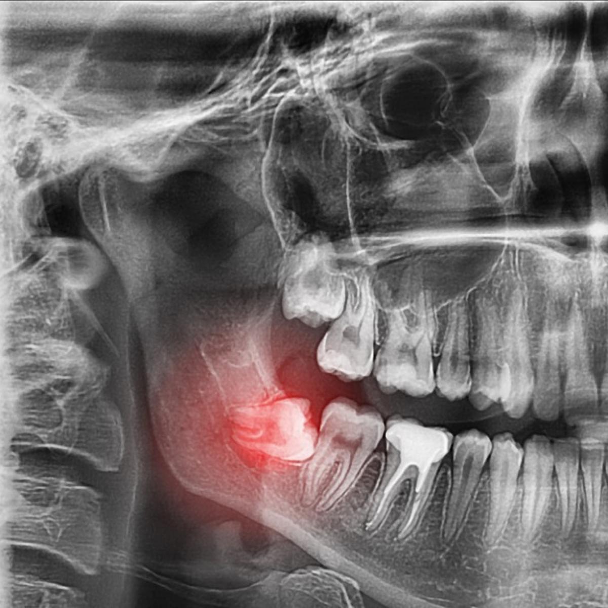 teeth